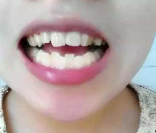 吃瓜双牙,一场关于美食与文化的跨界盛宴